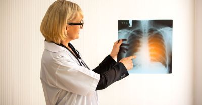 200 przeszczepień płuc w siedem lat w Uniwersyteckim Centrum Klinicznym